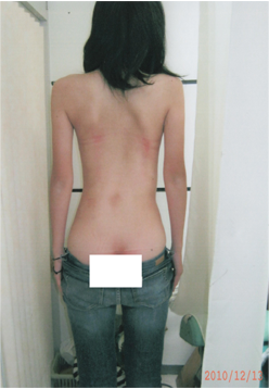 改善後立位ボディ写真