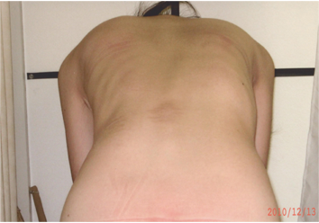 改善後前屈ボディ写真