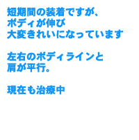 短期間の装着ですがボディが伸び大変きれいになっています。左右のボディラインと肩が平行。現在も治療中