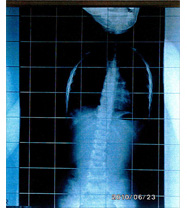 レントゲン平成22年6月23日