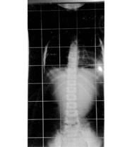 レントゲン平成22年11月24日