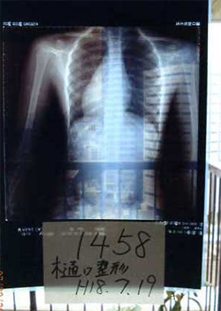 大塚式鍛錬体操後