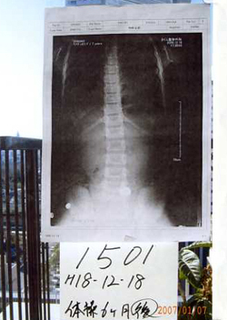 鍛錬体操6ヶ月後