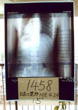 大塚式鍛錬体操前