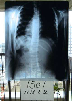 鍛錬体操6ヶ月前