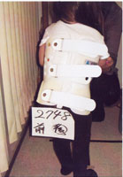 アメリカより来院2歳